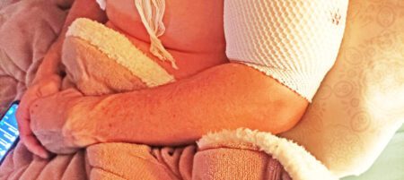 Convaleciente, en su casa con el brazo baleado