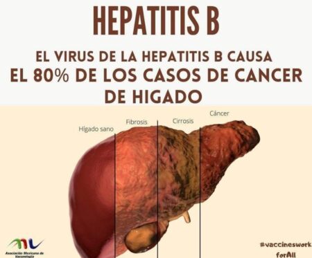 De no tratarse a tiempo la hepatitis puede derivar en Cáncer
